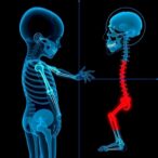 advancing-pediatric-sarcopenia-diagnosis:-new-insights