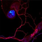 proteomic-analysis-of-fetal-membrane-defect-sites