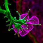 baicalin’s-tumor-fighting-role-in-melanoma-revealed