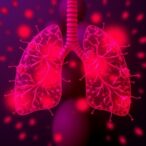 gsk-j4-inhibits-tumors-in-lung-cancer-cells
