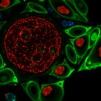 dj1-regulates-autophagy-in-ovarian-cancer-via-jnk