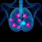 ensemble-learning-predicts-breast-cancer-surgery-costs