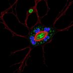 e2f8-boosts-dtl,-driving-endometrial-cancer-via-mapk