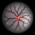 revolutionizing-retinal-vessel-classification-with-y-net-networks