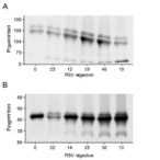 dna-methyltransferase-3-alpha-expression-in-rsv-infection