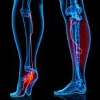 exploring-hxsj-decoction’s-role-in-ferroptosis-and-venous-leg-ulcers