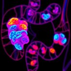 tp53-lgals4-axis-enhances-anti-pd-l1-colorectal-cancer-therapy