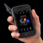 handheld-photoacoustic-probe-merges-ultrasound,-fiber-scanner