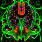 4r-tau-seeding-uncovers-progressive-supranuclear-palsy-subtypes