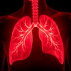 bioavailable-testosterone-lowers-lung-squamous-cell-carcinoma-risk