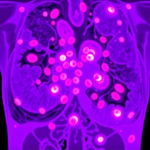 ai-classifies-tumor-infiltrating-lymphocytes-in-breast-cancer