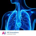 ai-innovations-in-non-small-cell-lung-cancer-care