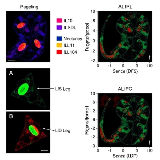il-10-targeting-ldl-lowers-vascular-inflammation-in-atherosclerosis