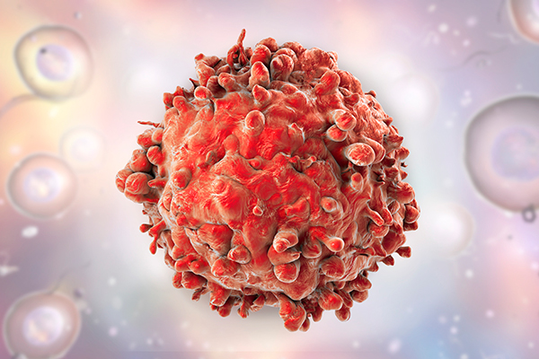 rare-inherited-genetic-variant-protects-against-blood-cancer,-reduces-leukemia-risk