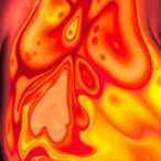 unique-case:-hyperemesis-gravidarum-with-thyrotoxicosis-and-ketoacidosis