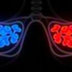 cbx2-enhances-ovarian-cancer-resistance-to-cisplatin