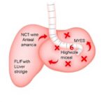 precision-prognosis:-mrd-and-vaf-in-liver-metastases