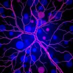 linking-lymphatic-damage-and-insulin-resistance-in-t2dm