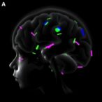 pqbp1-y65c-mutation-drives-microcephaly-and-deficits