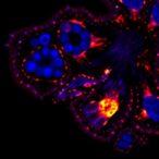 mettl3-loss-drives-glioma-via-macrophage-lipids