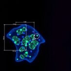 pt(o,o′-acac)(γ-acac)(dms)-triggers-mitochondrial,-autophagy-damage-in-u251