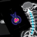 flexible-multimodal-imaging-marker-enhances-surgical-navigation