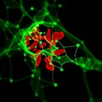 dual-nanocarriers-target-smad3-and-runx2-in-aortic-valve-disease