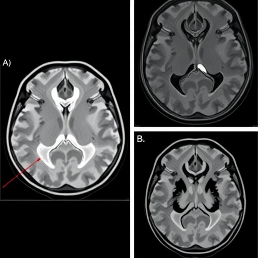 forensic-age-estimation-via-elbow-mri-in-chinese