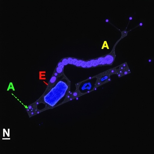 crispr-targets-notch2nlc-ggc-repeats-to-treat-niid