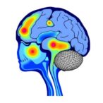 brain-lesions-impact-postural-control-in-spastic-cp
