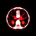 exploring-limited-ct-scan-impact-with-automated-models