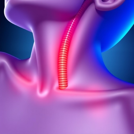 wireless-implant-tracks-airway-stent-migration-continuously