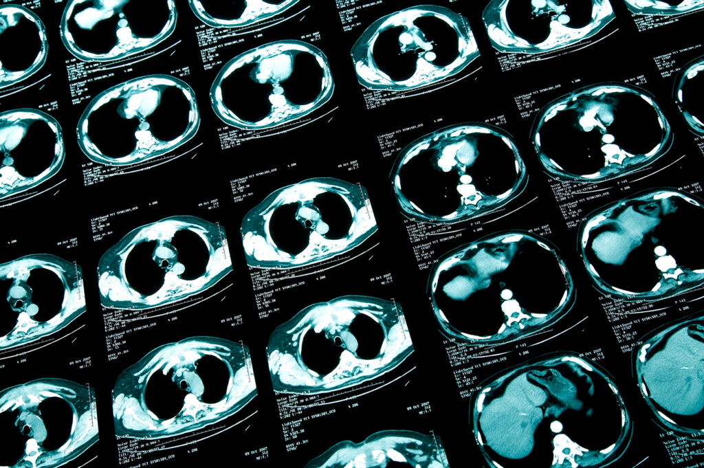 improving-biopharma-sponsor-access-to-clinical-trial-imaging-data