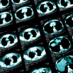 improving-biopharma-sponsor-access-to-clinical-trial-imaging-data