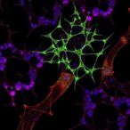 matrine-b10-targets-fgfr3-pathway-to-fight-liver-cancer