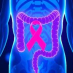 new-genes-and-factors-linked-to-colorectal-cancer