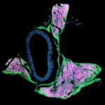 how-beige-fat-works-to-promote-healthy-blood-pressure-in-mice