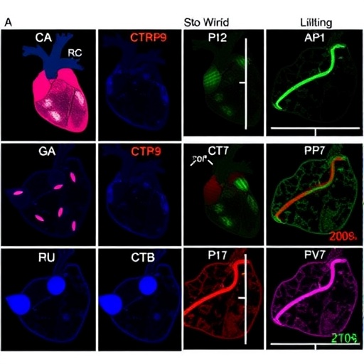 ctrp9-enhances-heart-failure-by-modulating-lipid-metabolism