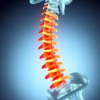 navigating-osteoporotic-vertebral-fractures:-insights-from-patients-and-professionals