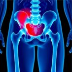 innovative-model-cuts-mortality-in-high-risk-hip-fractures