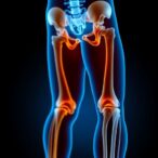 understanding-rehabilitation-goals-for-hip-fracture-recovery
