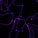 demystifying-histone-demethylases’-role-in-breast-cancer