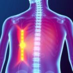 vitamin-d-fortification’s-impact-on-bone-health-in-uae