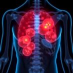 sarcopenia:-widespread-issue-among-older-pakistanis