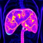 revolutionary-nir-ii-imaging-spotlights-liver-tumors