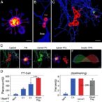 unraveling-epigenetic-control-of-t-cell-exhaustion-in-cancer