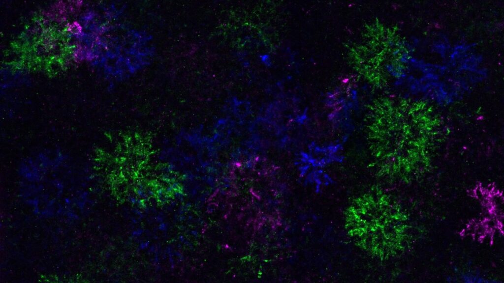 oligodendrocyte-differentiation-holds-promise-for-ms-treatment-development