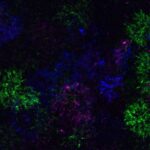 oligodendrocyte-differentiation-holds-promise-for-ms-treatment-development