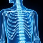 key-factors-linked-to-vertebral-fractures-in-osteoporosis