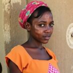 impact-of-housing-insecurity-on-skin-disease-care